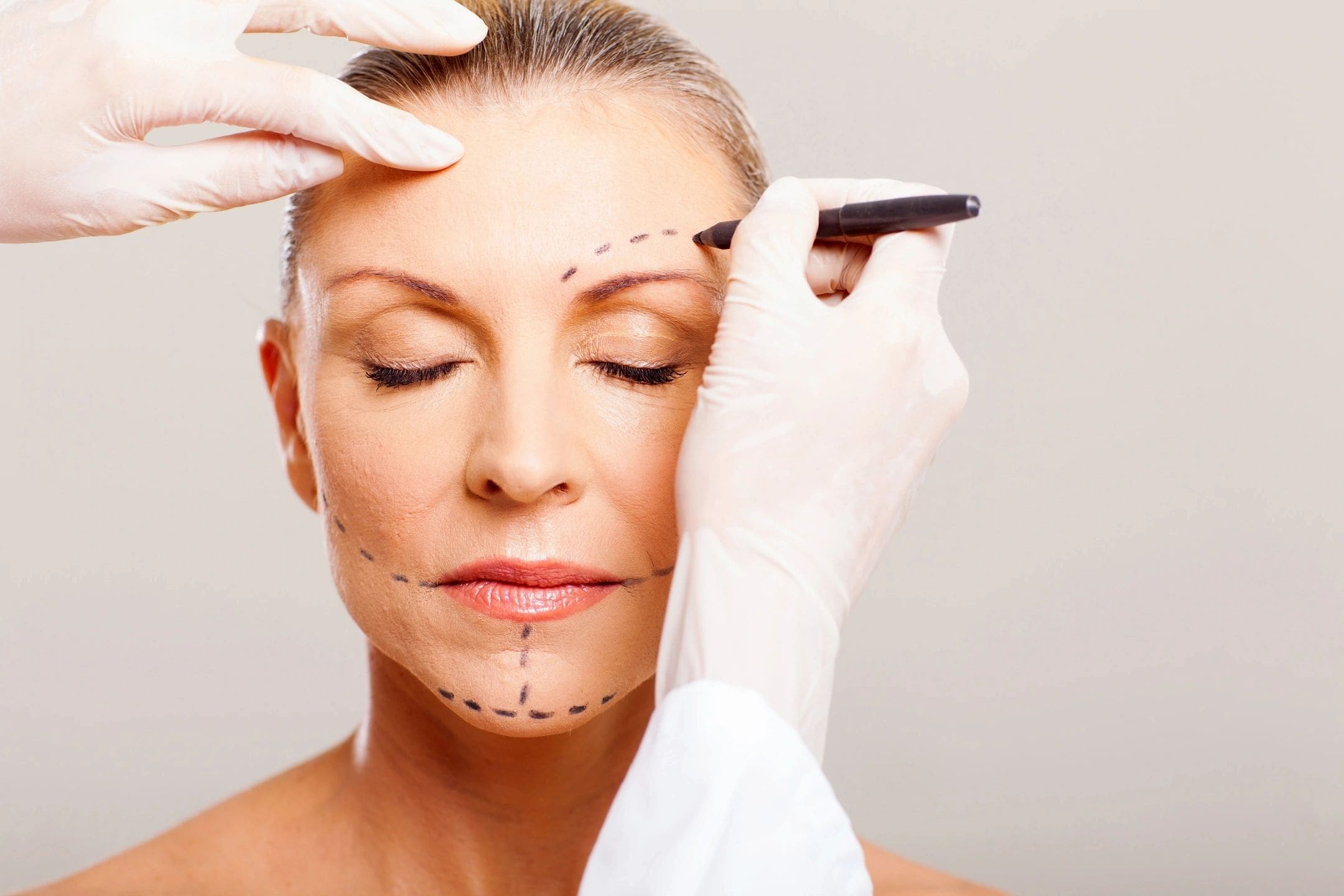 A woman with surgical marks on her face and hands.