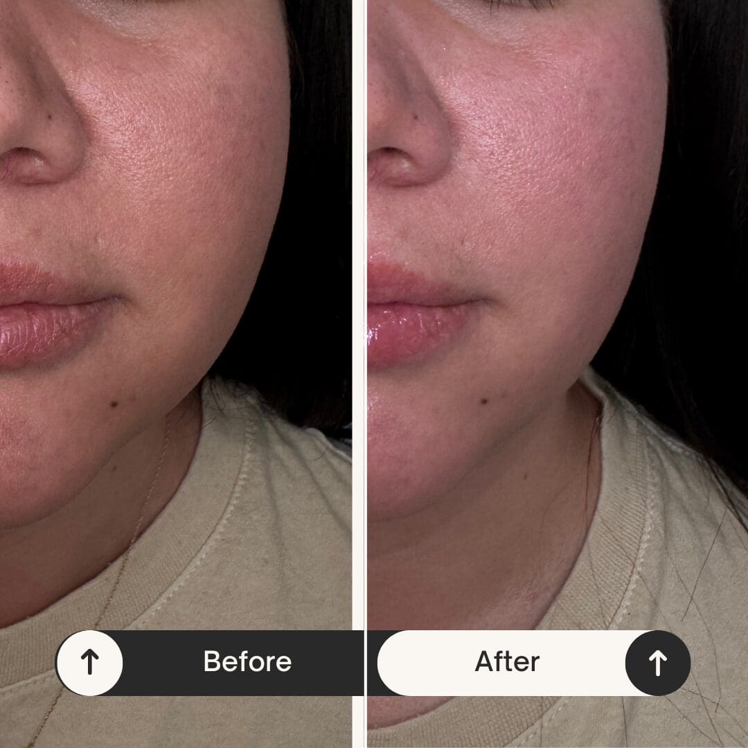 Before and After Half Face